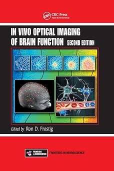 In Vivo Optical Imaging of Brain Function - Best Deal Finder