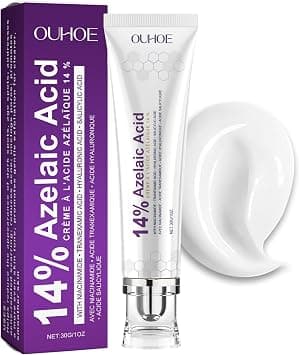 Nigwedete丨14% Azelaic Acid Acne Cream丨Advanced Azelaic Acid Serum丨Redness Relief for Face, Redness Reducing Skin Care丨Prevents Acne Breakouts, Ease Pimple Clarify Skin Soothe Irritation - Best Deal Finder
