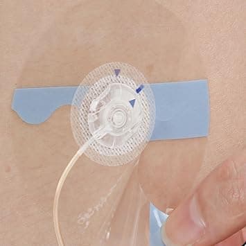 60Pcs Universal Adhesive Patches for CGM and Insulin Pumps, 0.8-Inch Hole, Breathable Clear Patches & Waterproof CGM Sensor Patches 10-14Day, CGM Protection, Pre-Cut Adhesive Tape, Skin-Friendly Patch on Amazon.ae - Price Tracker